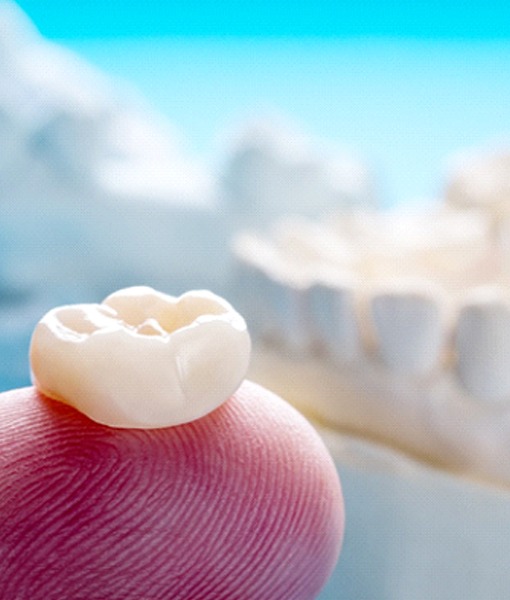 Closeup of dental crown in Edmonton on finger