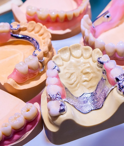 Closeup of different types of dentures in Edmonton
