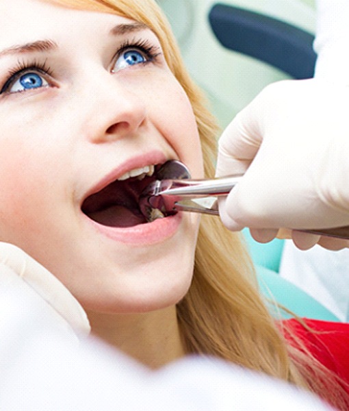 Dentist in Edmonton performing tooth extraction
