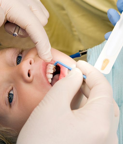 Child receiving silver diamine fluoride treatment