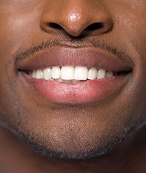 Closeup of beautiful smile thanks to Edmonton cosmetic dentist 